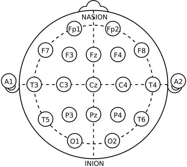 最常用的两种导联,一个是参考导联,就是测量头皮电位和耳朵电位的